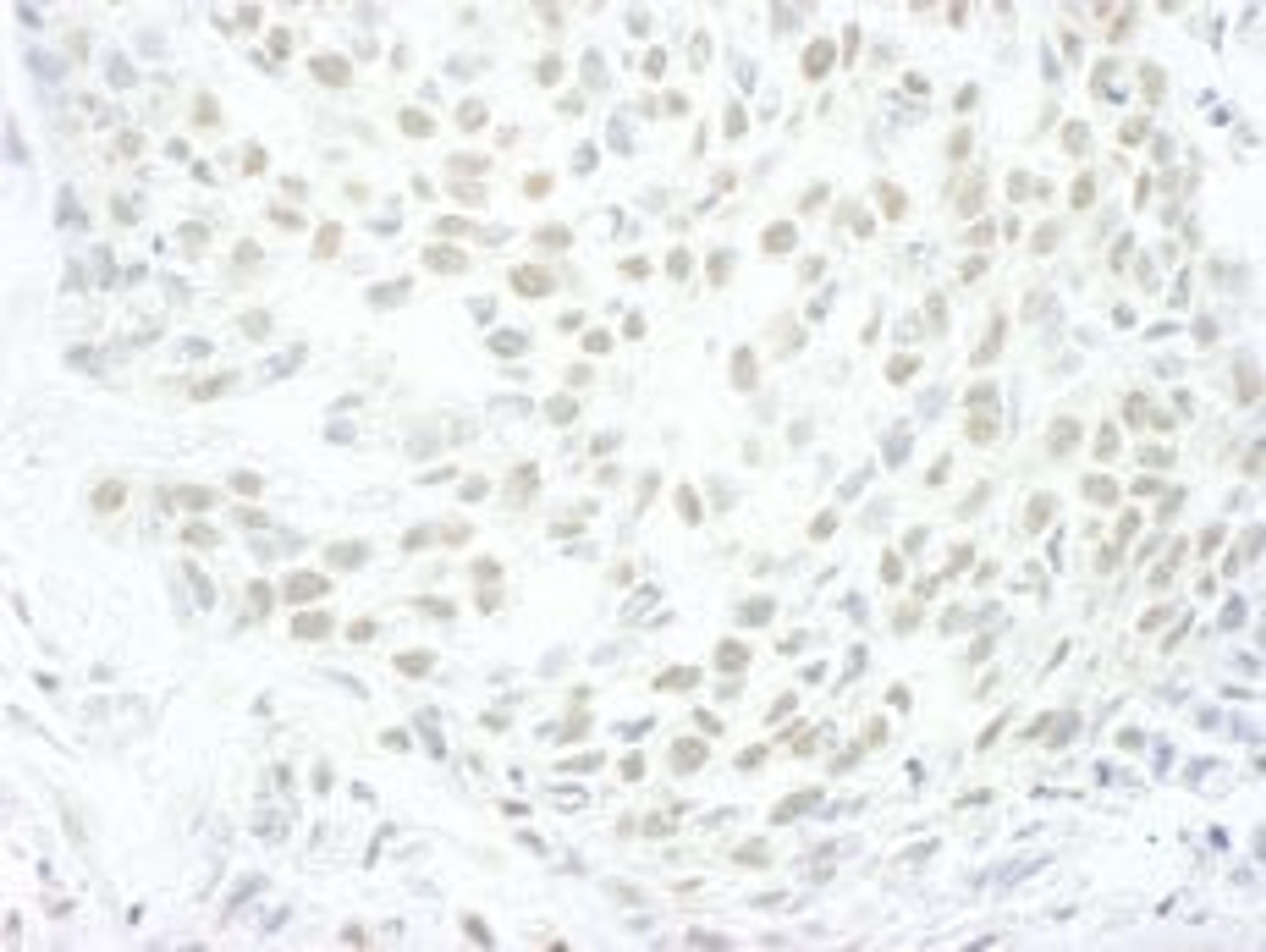 Detection of human MLLT1by immunohistochemistry.