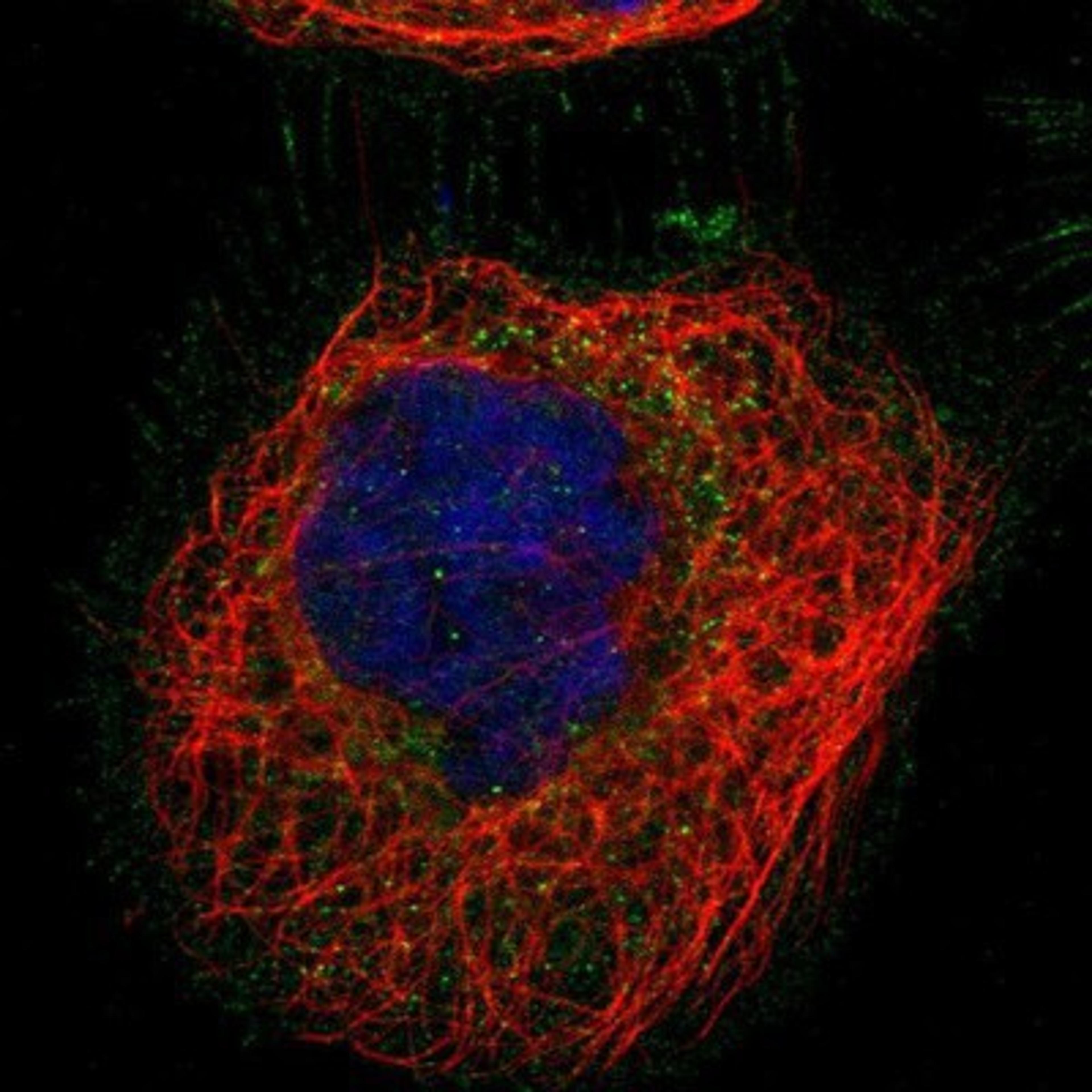 Immunocytochemistry/Immunofluorescence: ARHGAP24 Antibody [NBP1-84161] Staining of human cell line A-431 shows positivity in plasma membrane & cytoplasm.