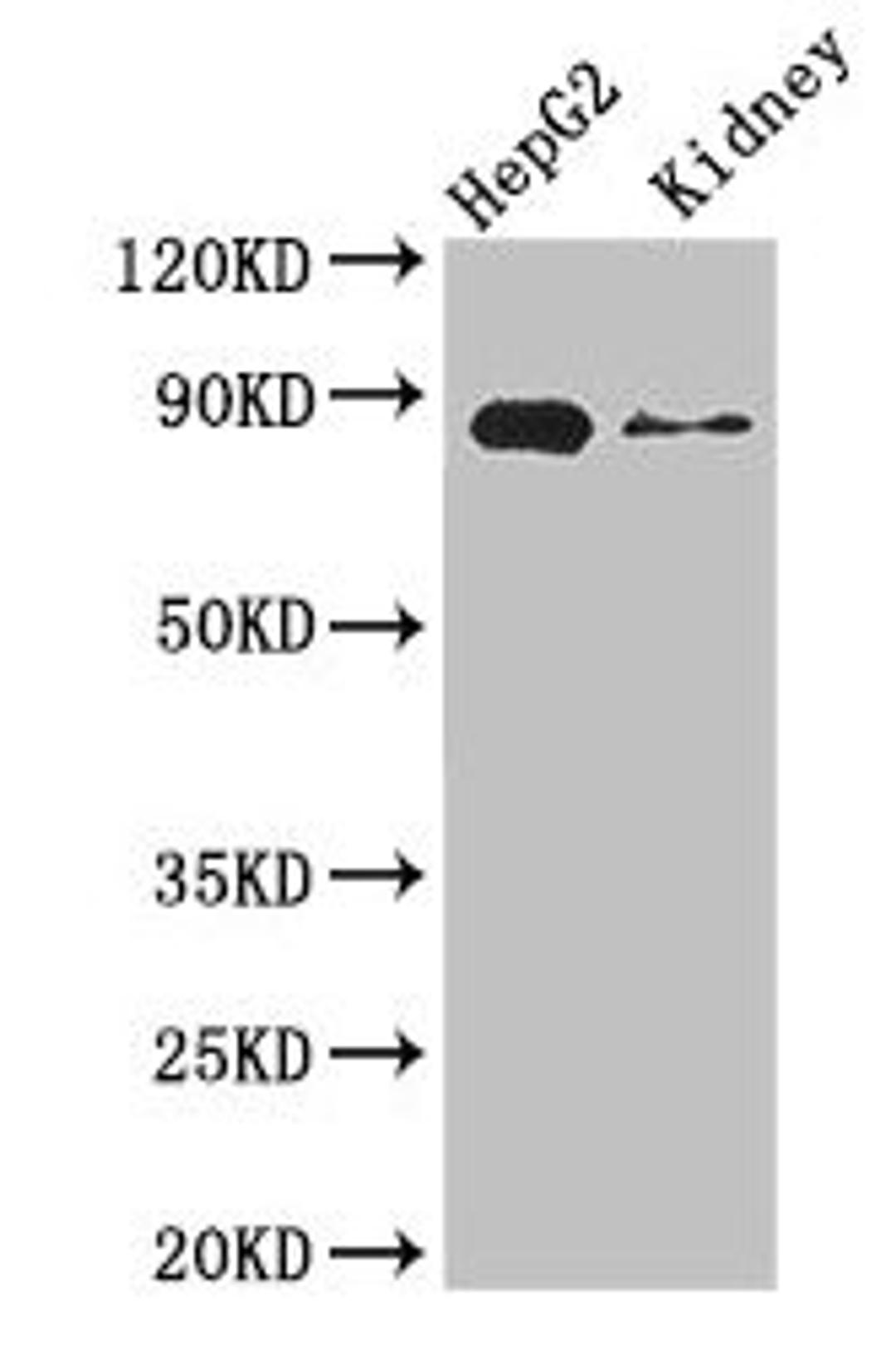 Western Blot. Positive WB detected in: HepG2 whole cell lysate, Mouse kidney tissue. All lanes: CPT1A antibody at 3.4ug/ml. Secondary. Goat polyclonal to rabbit IgG at 1/50000 dilution. Predicted band size: 89, 87 kDa. Observed band size: 89 kDa. 