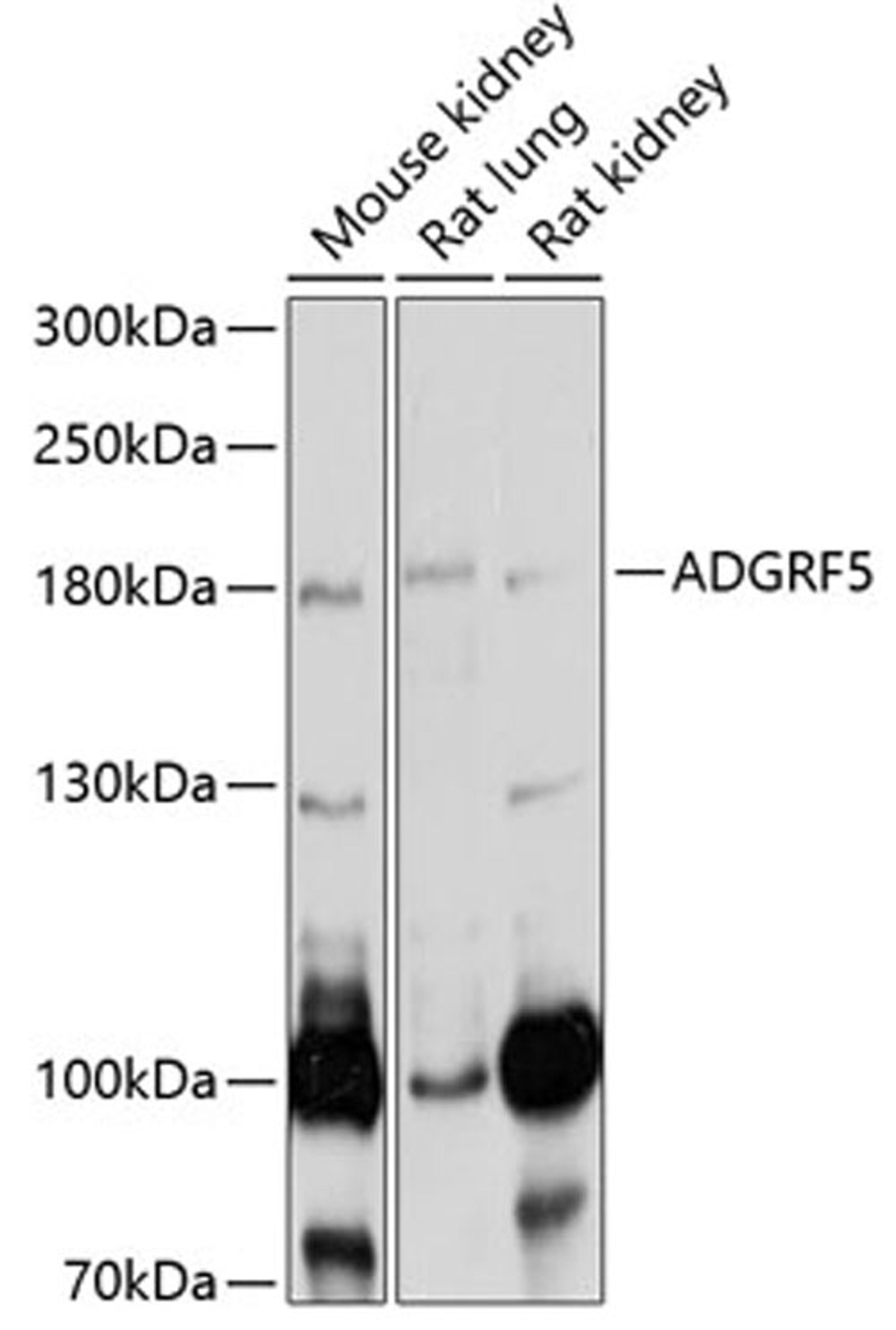 Western blot - ADGRF5 antibody (A5205)