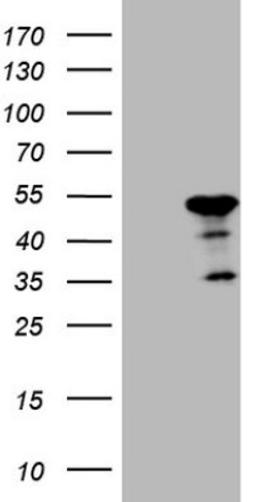 Western Blot: ATP6V1C2 Antibody (8H4) [NBP2-46556] - Analysis of HEK293T cells were transfected with the pCMV6-ENTRY control (Left lane) or pCMV6-ENTRY ATP6V1C2.