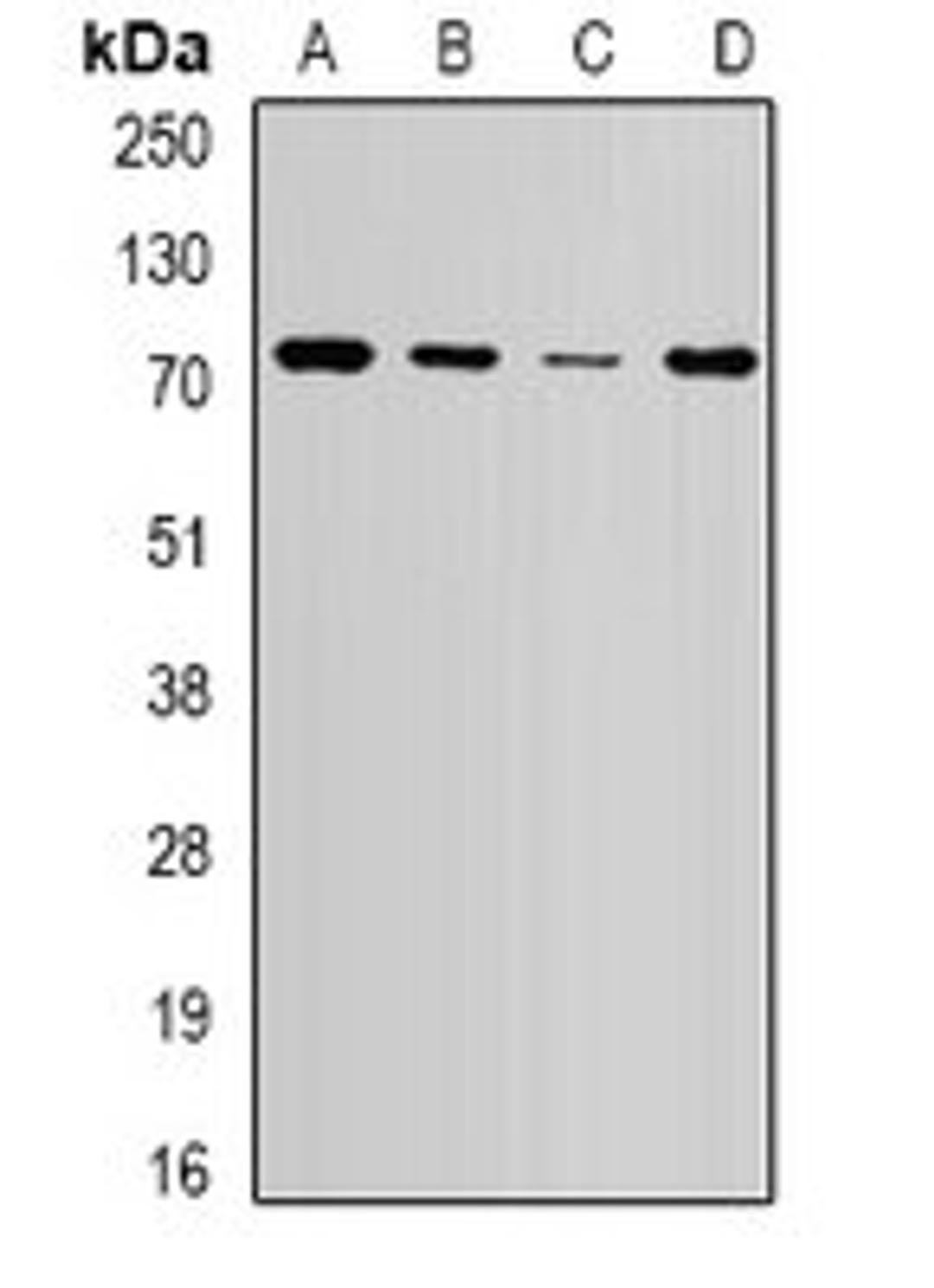 Western blot analysis of HepG2 (Lane1), SW620 (Lane2), mouse brain (Lane3), mouse spleen (Lane4) whole cell lysates using WHSC1 antibody