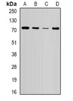 Western blot analysis of HepG2 (Lane1), SW620 (Lane2), mouse brain (Lane3), mouse spleen (Lane4) whole cell lysates using WHSC1 antibody