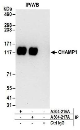 Detection of human CHAMP1 by western blot of immunoprecipitates.