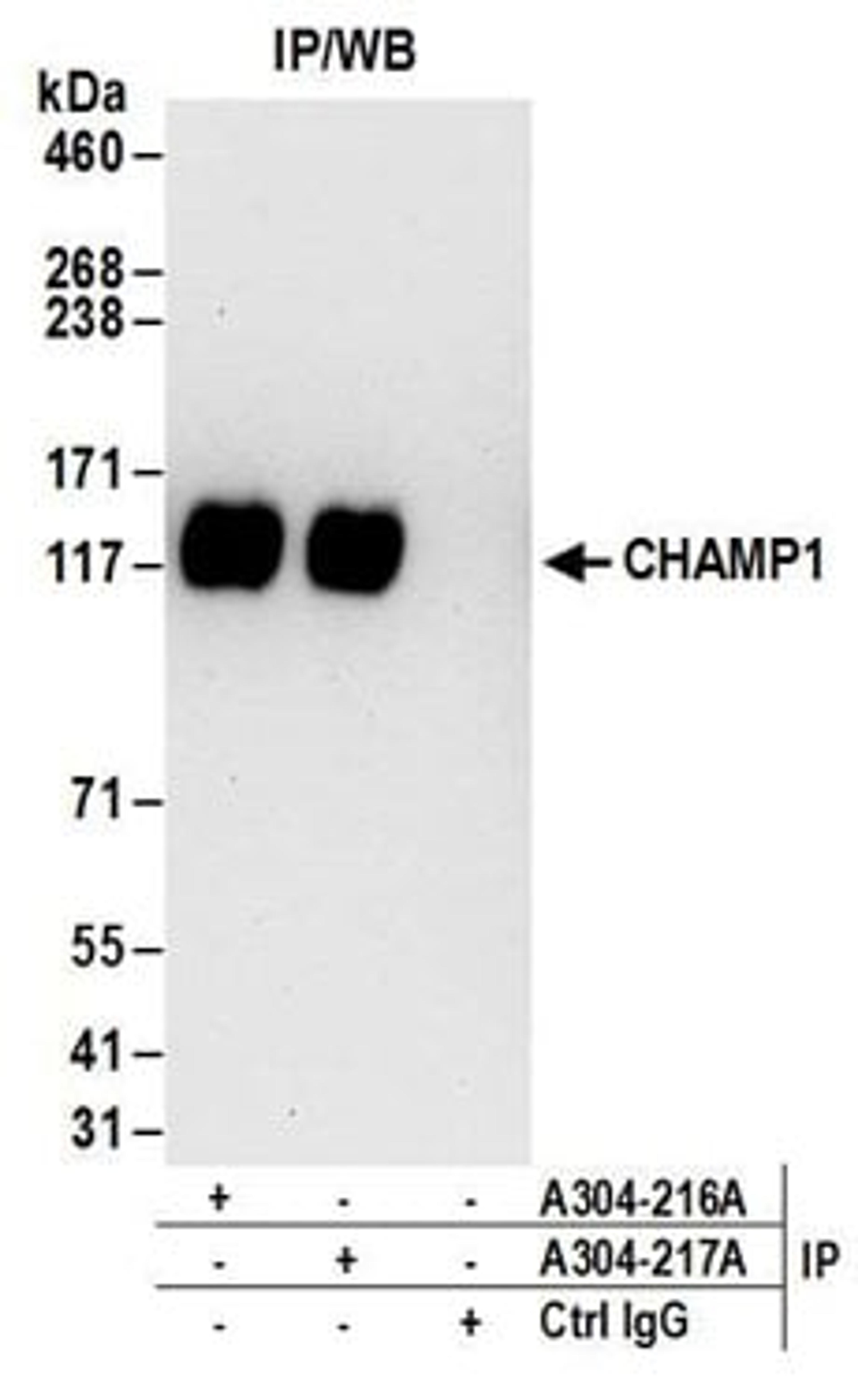 Detection of human CHAMP1 by western blot of immunoprecipitates.