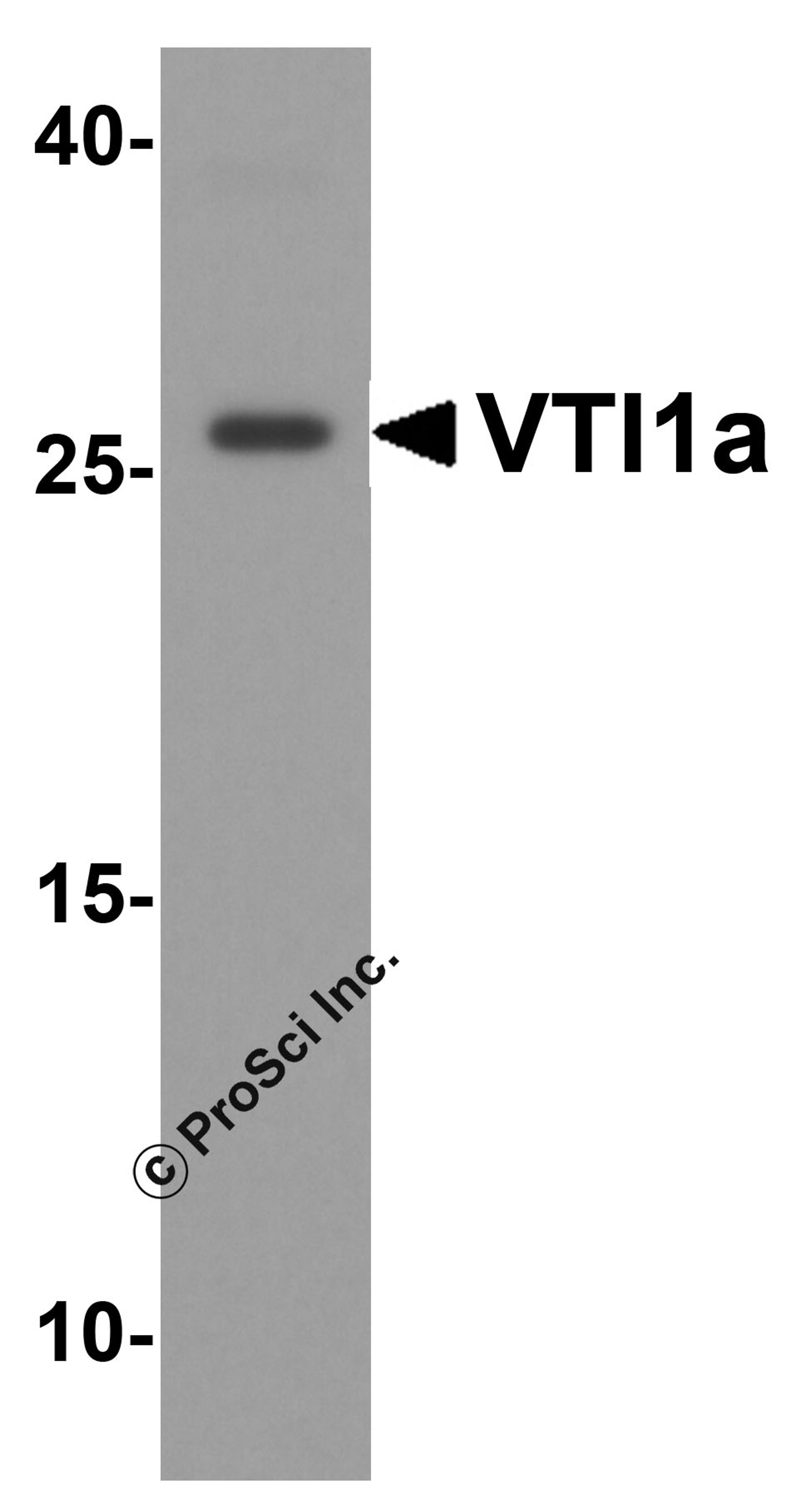 Western blot analysis of VTI1a in human brain tissue lysate with VTI1a antibody at 1 &#956;g/ml.