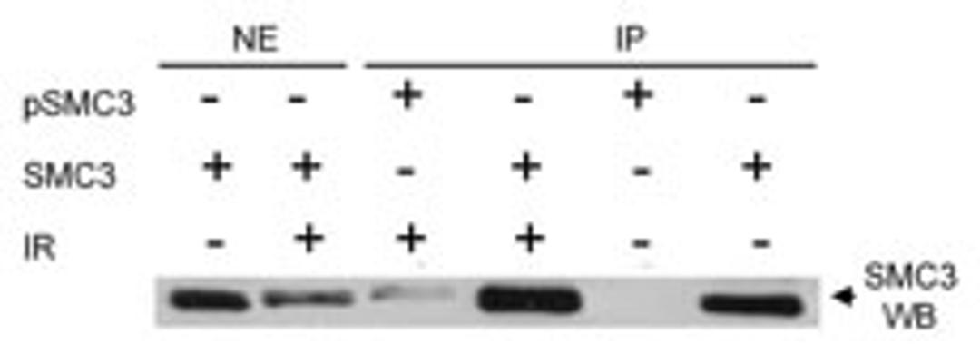 immunoprecipitation of human Phospho SMC3 (Ser383).