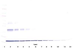 To detect Murine TNF-alpha by Western Blot analysis this antibody can be used at a concentration of 0.1-0.2 ug/ml. When used in conjunction with compatible secondary reagents, the detection limit for recombinant Murine TNF-alpha is 1.5-3.0 ng/lane, under