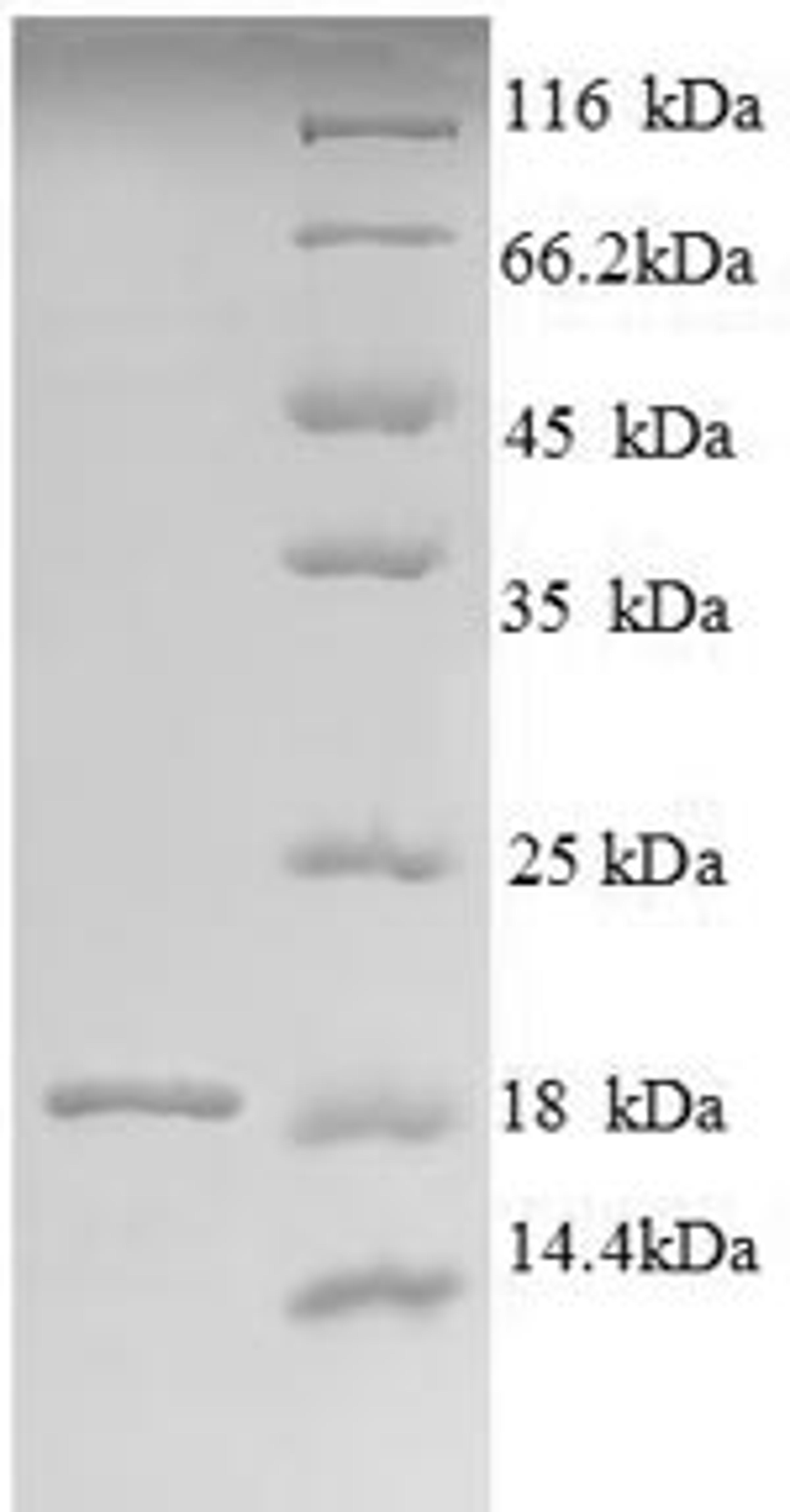 (Tris-Glycine gel) Discontinuous SDS-PAGE (reduced) with 5% enrichment gel and 15% separation gel.