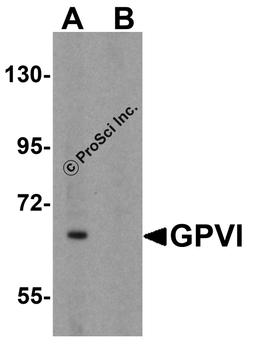 Western blot analysis of GPVI in K562 cell lysate with GPVI antibody at 1 μg/mL in (A) the absence and (B) the presence of blocking peptide.