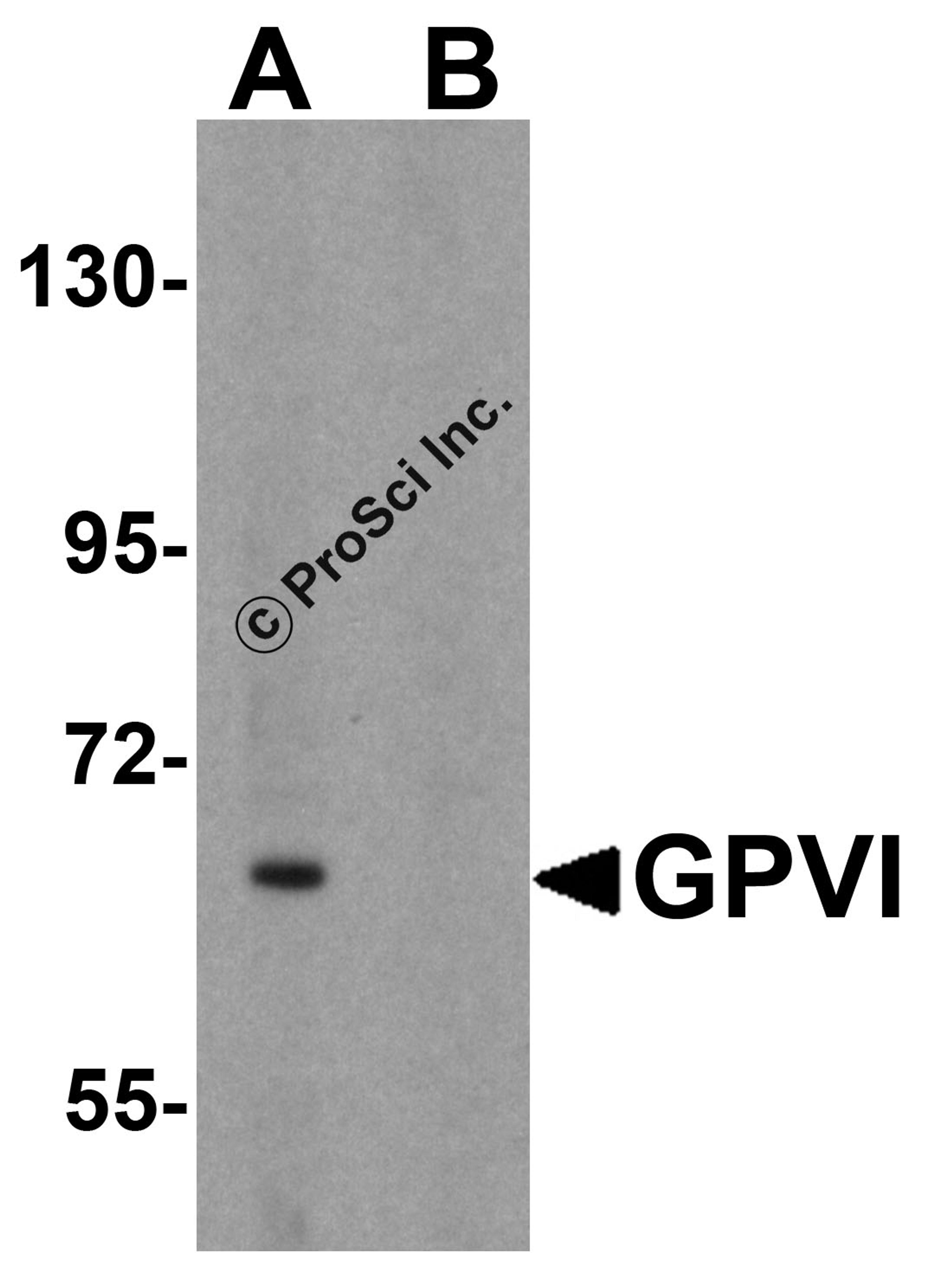 Western blot analysis of GPVI in K562 cell lysate with GPVI antibody at 1 μg/mL in (A) the absence and (B) the presence of blocking peptide.