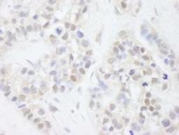 Detection of human MAGED2 by immunohistochemistry.