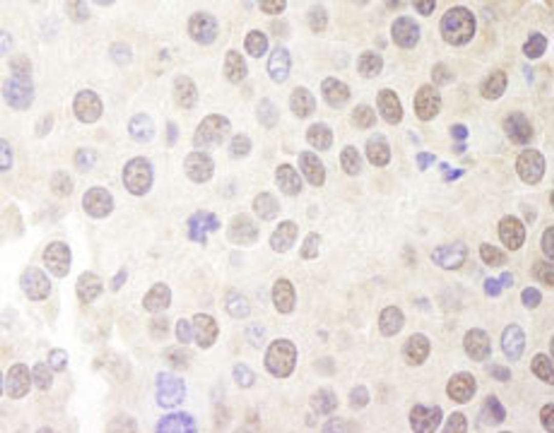 Detection of mouse Menin by immunohistochemistry.