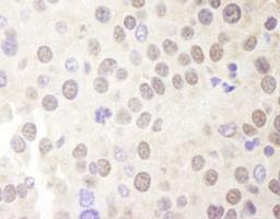 Detection of mouse Menin by immunohistochemistry.