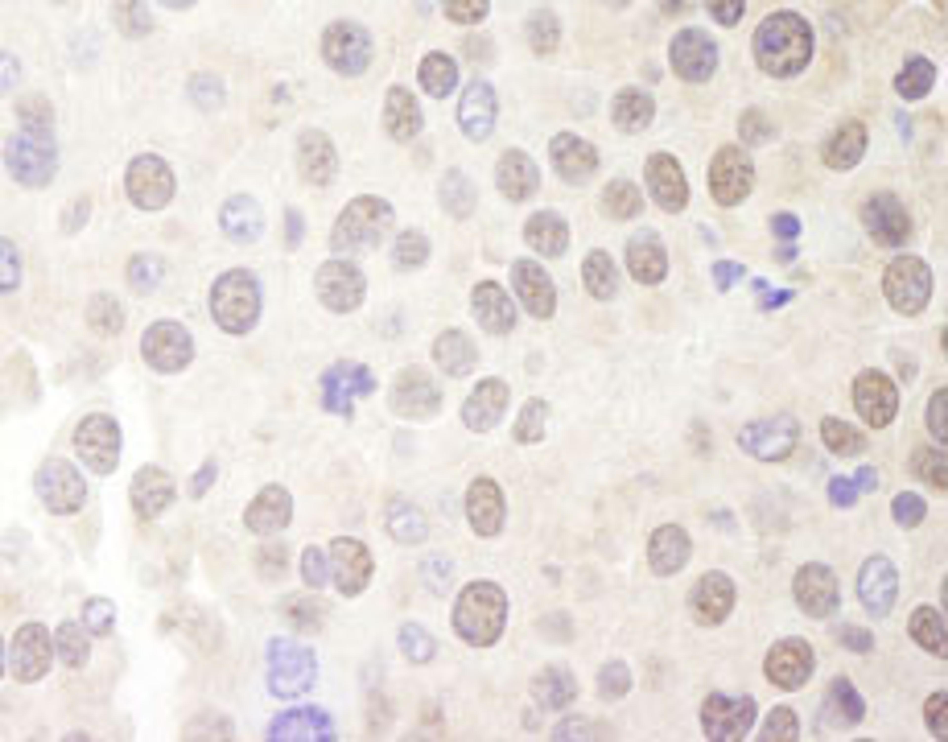 Detection of mouse Menin by immunohistochemistry.