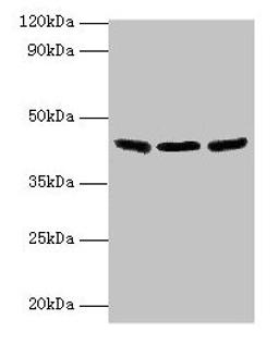 Western blot. All lanes: IDH3B antibody at 2µg/ml. Lane 1: Hela whole cell lysate. Lane 2: Mouse kidney tissue. Lane 3: Mouse gonadal tissue. Secondary. Goat polyclonal to rabbit IgG at 1/10000 dilution. Predicted band size: 43, 42, 26 kDa. Observed band size: 43 kDa