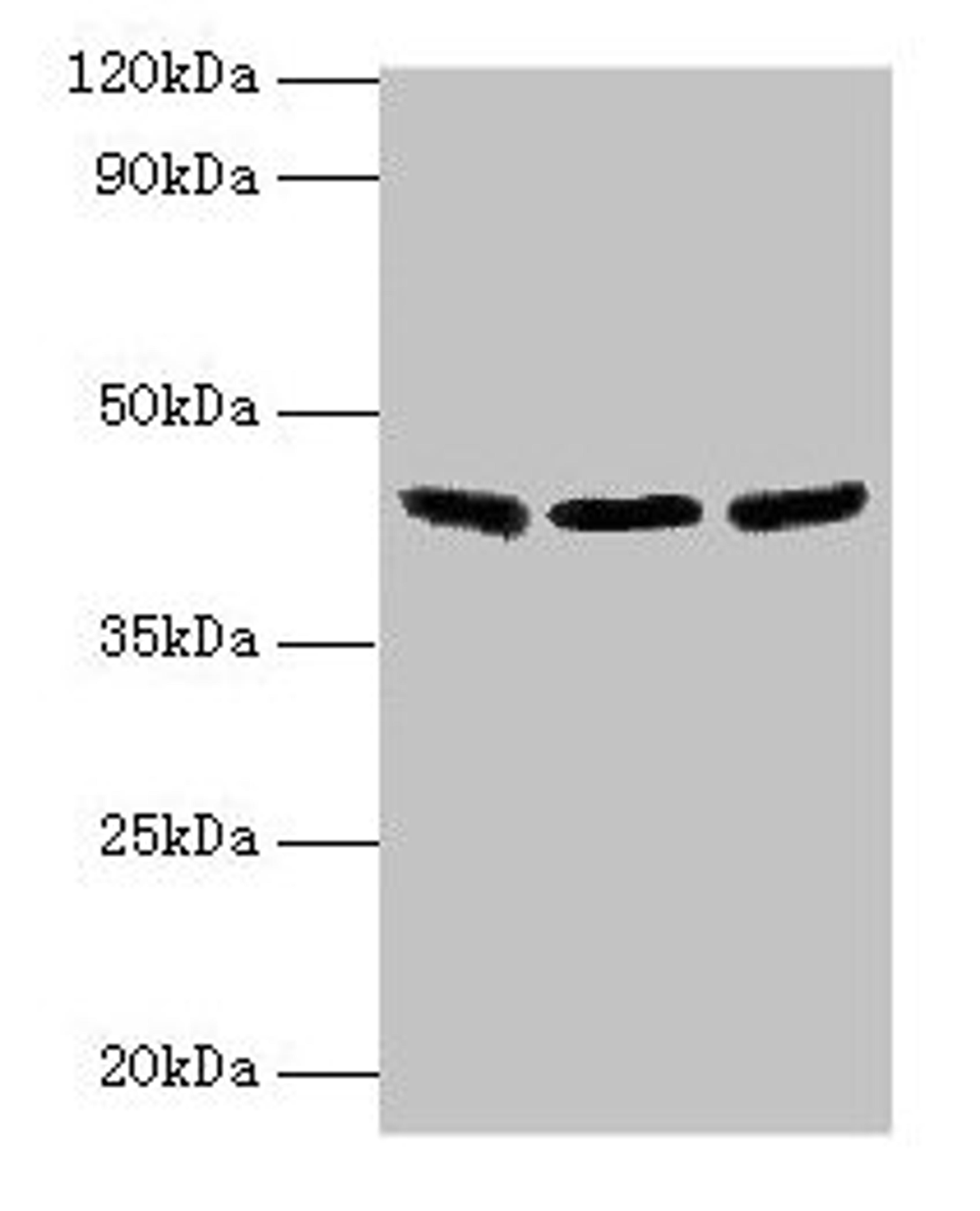 Western blot. All lanes: IDH3B antibody at 2µg/ml. Lane 1: Hela whole cell lysate. Lane 2: Mouse kidney tissue. Lane 3: Mouse gonadal tissue. Secondary. Goat polyclonal to rabbit IgG at 1/10000 dilution. Predicted band size: 43, 42, 26 kDa. Observed band size: 43 kDa