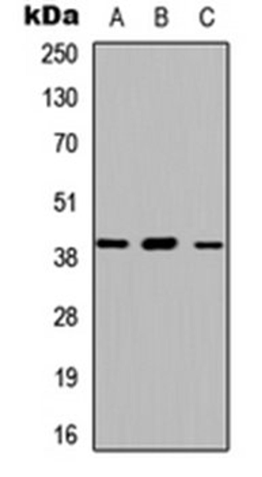 Western blot analysis of HEK293T (Lane 1), Raw264.7 (Lane 2), H9C2 (Lane 3) whole cell lysates using ABHD13 antibody