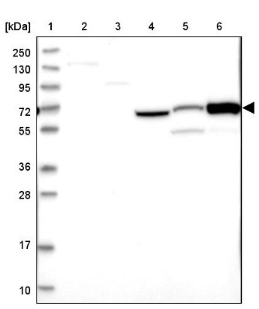 Western Blot: CNNM1 Antibody [NBP1-89281] - Lane 1: Marker [kDa] 250, 130, 95, 72, 55, 36, 28, 17, 10<br/>Lane 2: Human cell line RT-4<br/>Lane 3: Human cell line U-251MG sp<br/>Lane 4: Human plasma (IgG/HSA depleted)<br/>Lane 5: Human liver tissue<br/>Lane 6: Human tonsil tissue