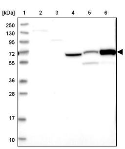 Western Blot: CNNM1 Antibody [NBP1-89281] - Lane 1: Marker [kDa] 250, 130, 95, 72, 55, 36, 28, 17, 10<br/>Lane 2: Human cell line RT-4<br/>Lane 3: Human cell line U-251MG sp<br/>Lane 4: Human plasma (IgG/HSA depleted)<br/>Lane 5: Human liver tissue<br/>Lane 6: Human tonsil tissue