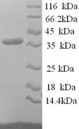 (Tris-Glycine gel) Discontinuous SDS-PAGE (reduced) with 5% enrichment gel and 15% separation gel.