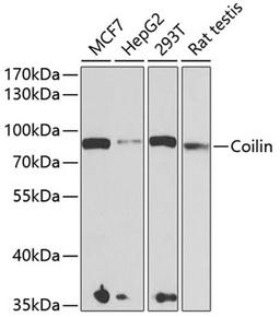 Western blot - Coilin antibody (A6428)