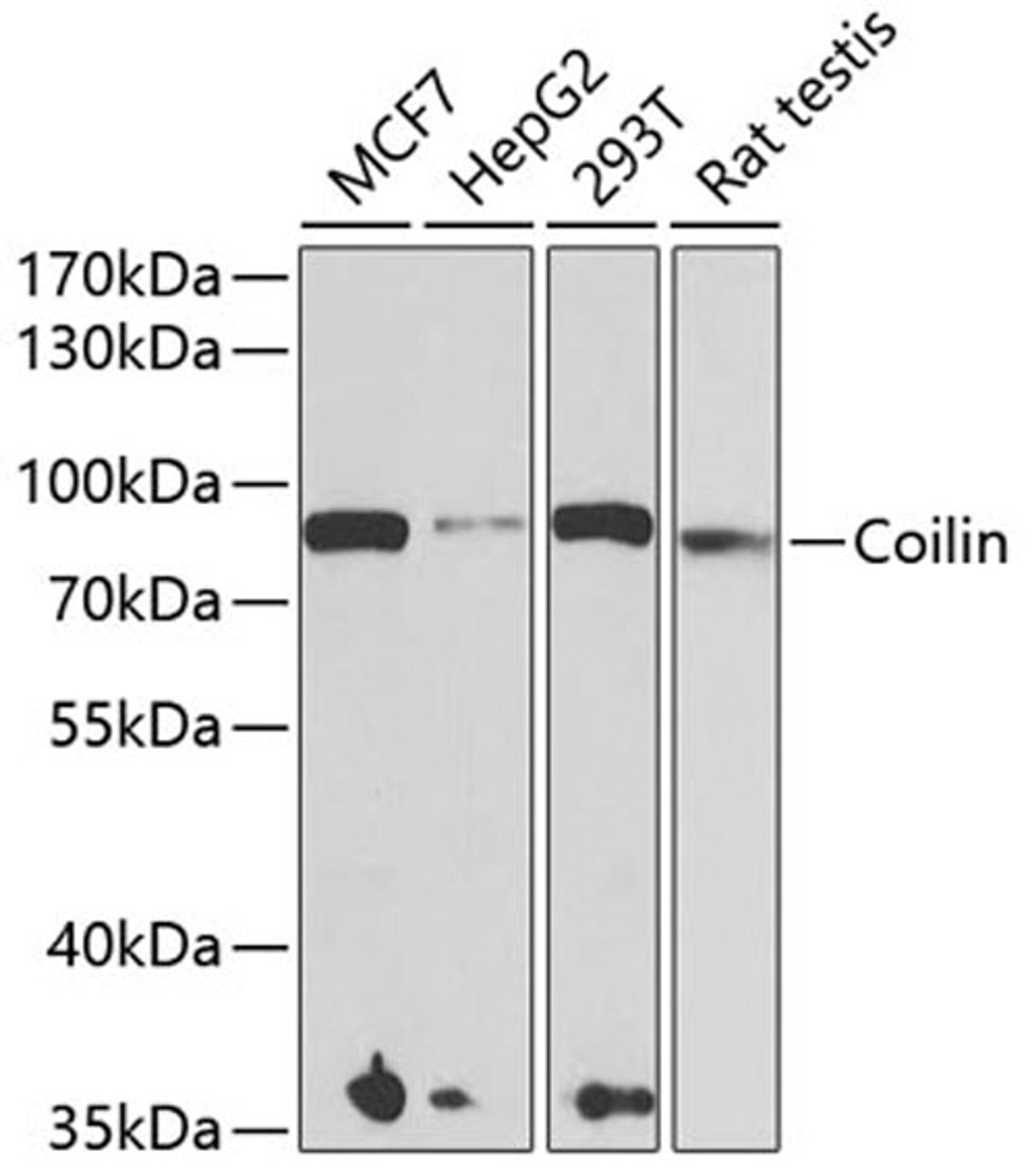 Western blot - Coilin antibody (A6428)