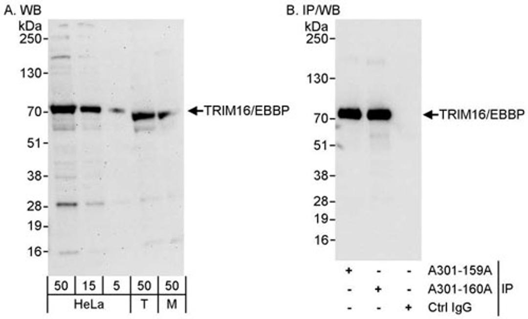 Detection of human and mouse TRIM16/EBBP by WB and IP.