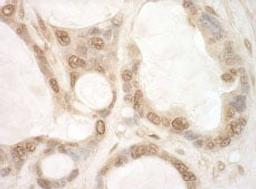 Detection of human eIF2B5 by immunohistochemistry.