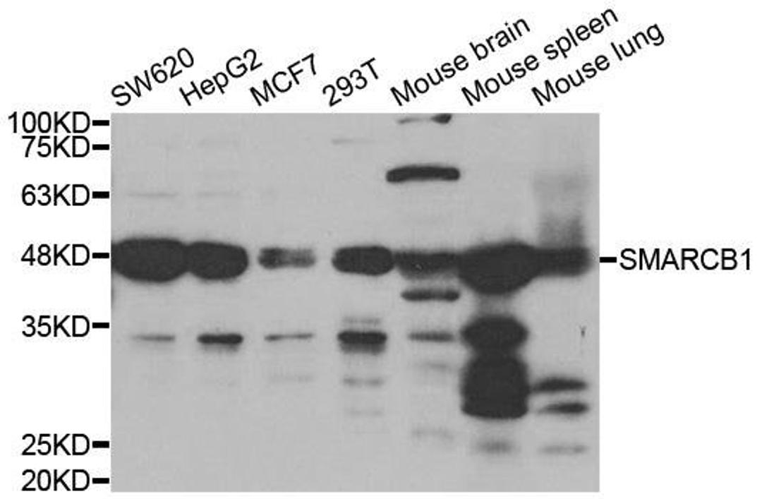 Western blot analysis of extracts of various cell lines using SMARCB1 antibody