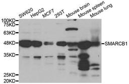 Western blot analysis of extracts of various cell lines using SMARCB1 antibody