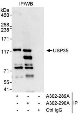 Detection of human USP35 by western blot of immunoprecipitates.