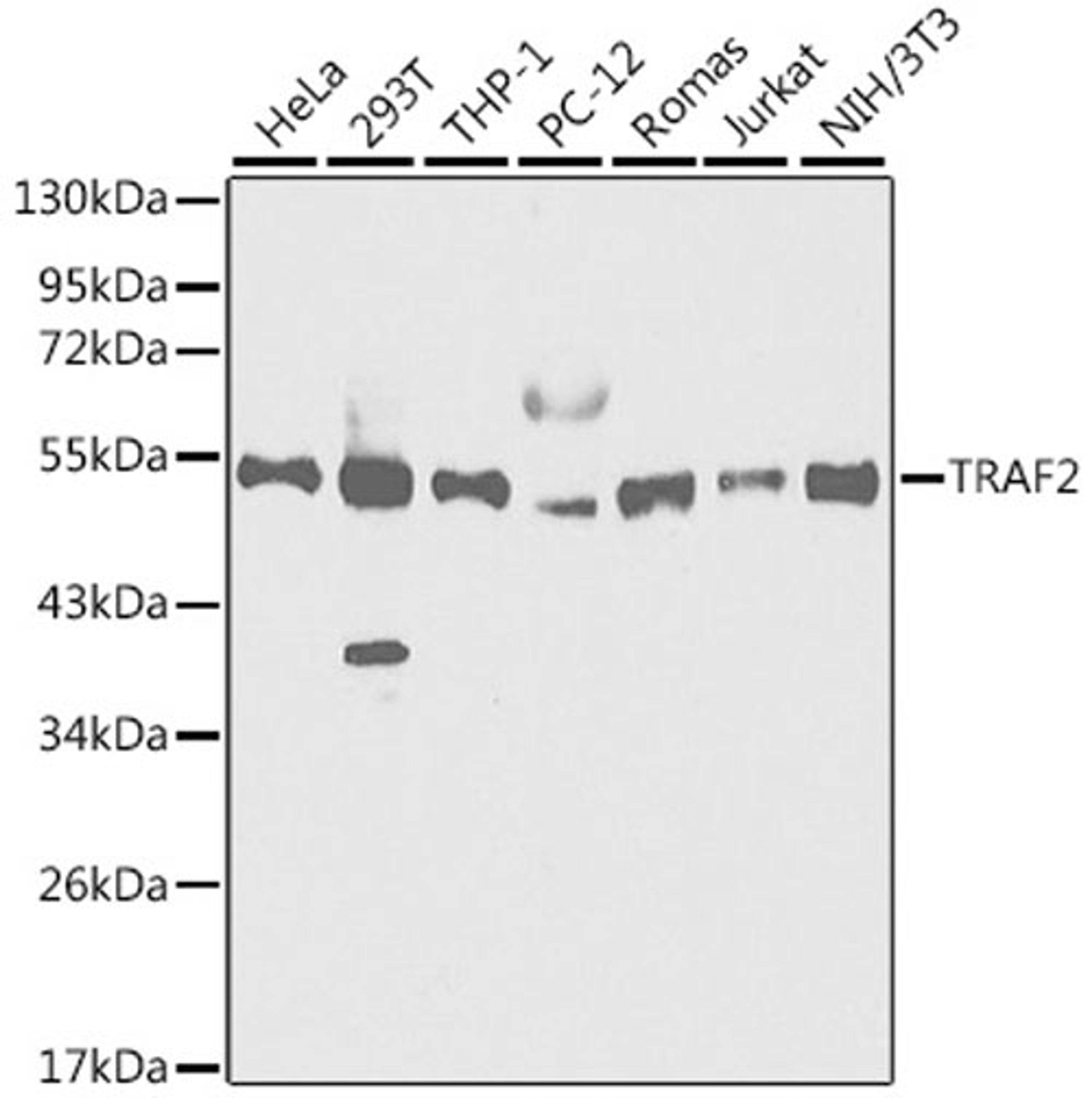 Western blot - TRAF2 antibody (A0962)