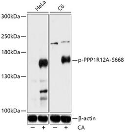 Western blot - Phospho-PPP1R12A-S668 antibody (AP0835)