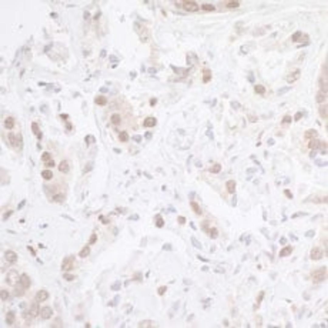 Detection of human CHD8 by immunohistochemistry.