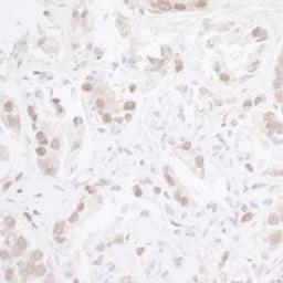 Detection of human CHD8 by immunohistochemistry.