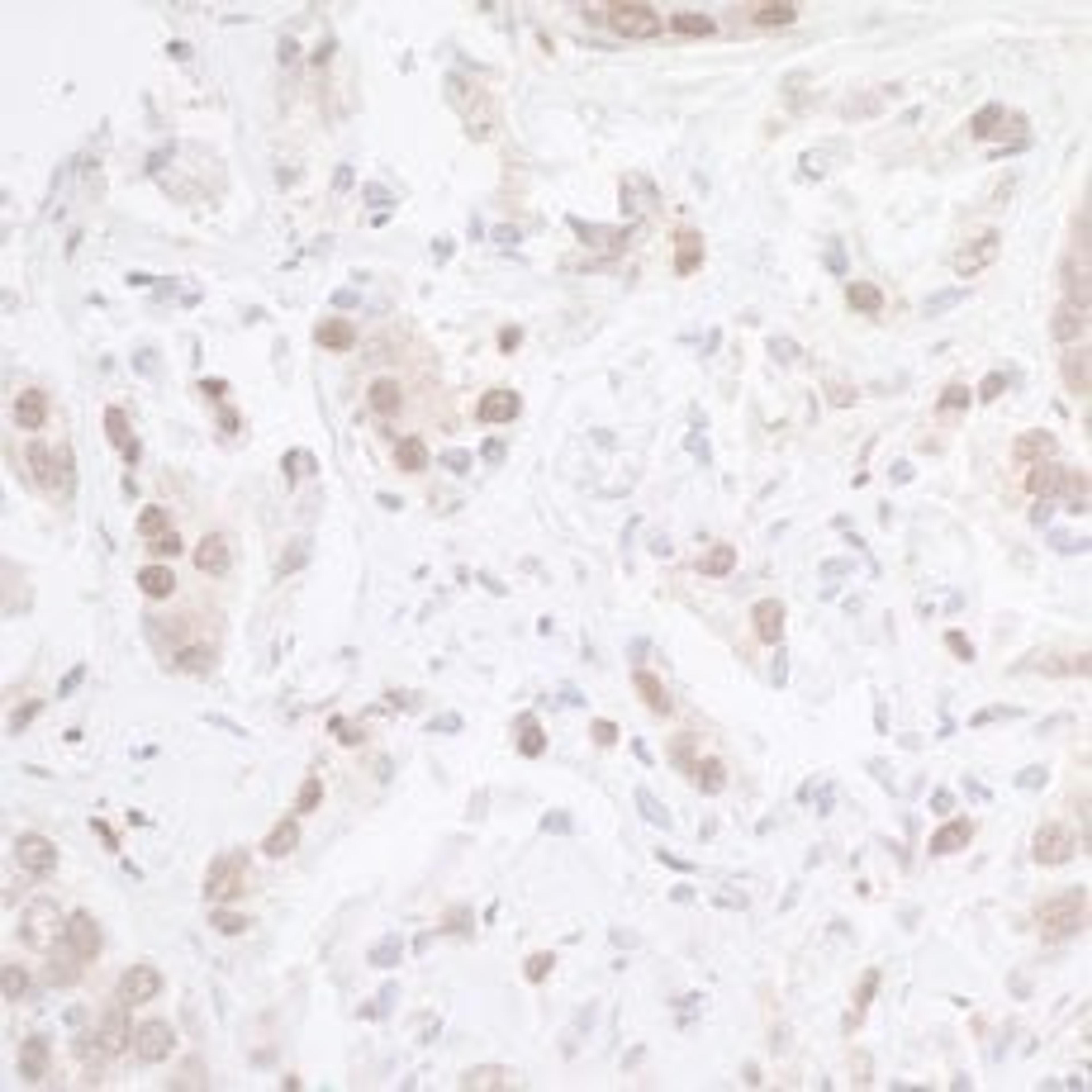 Detection of human CHD8 by immunohistochemistry.