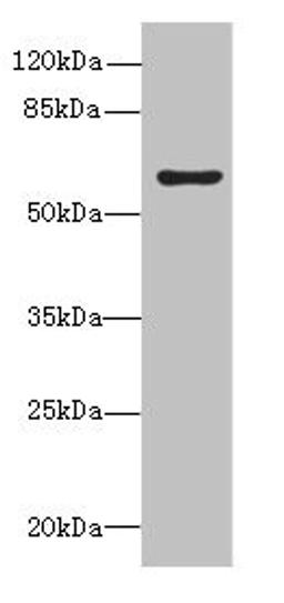 Western blot. All lanes: KHDC4 antibody at 5µg/ml + Mouse liver tissue. Secondary. Goat polyclonal to rabbit IgG at 1/10000 dilution. Predicted band size: 65, 60, 41, 25 kDa. Observed band size: 65 kDa