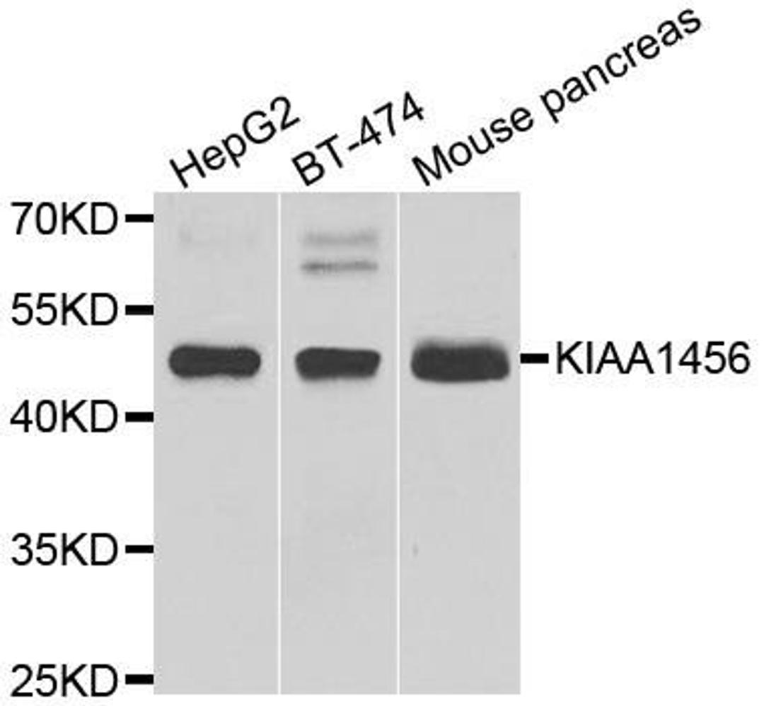 Western blot analysis of extracts of various cell lines using KIAA1456 antibody