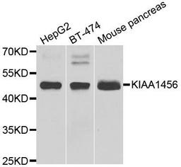 Western blot analysis of extracts of various cell lines using KIAA1456 antibody