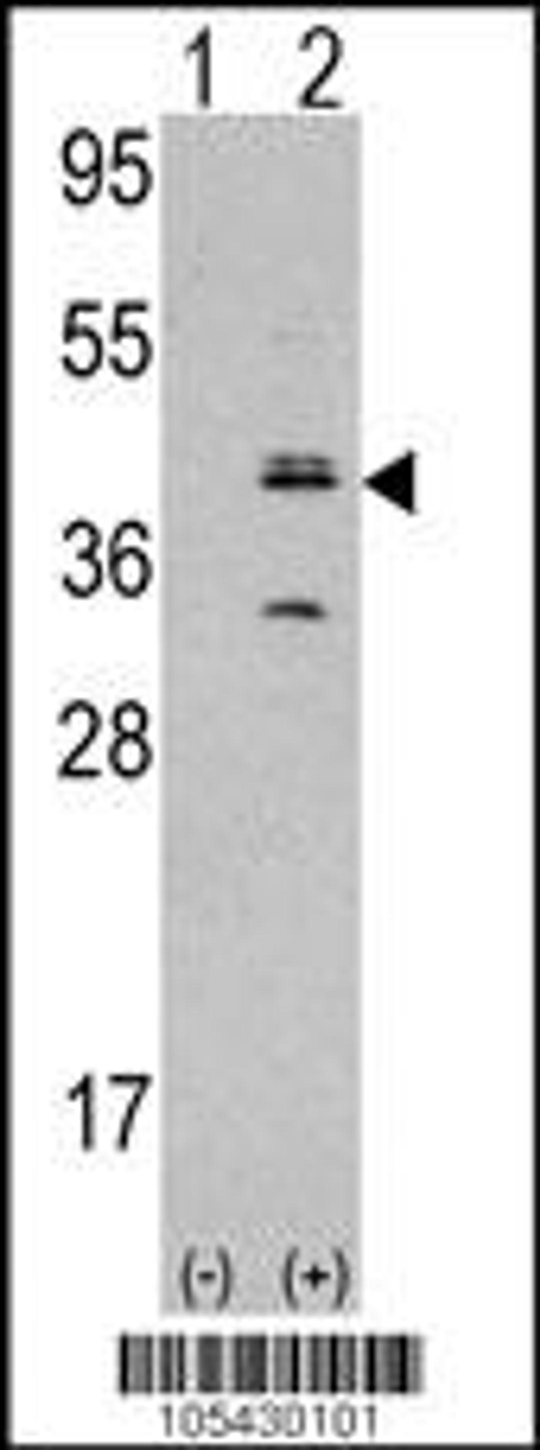 Western blot analysis of MVK using rabbit polyclonal MVK Antibody using 293 cell lysates (2 ug/lane) either nontransfected (Lane 1) or transiently transfected with the MVK gene (Lane 2).