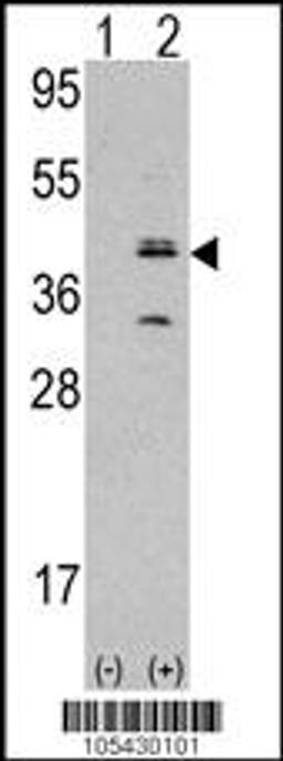 Western blot analysis of MVK using rabbit polyclonal MVK Antibody using 293 cell lysates (2 ug/lane) either nontransfected (Lane 1) or transiently transfected with the MVK gene (Lane 2).