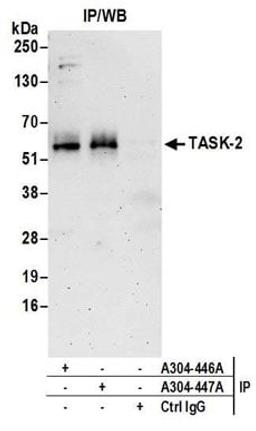 Detection of human TASK-2 by western blot of immunoprecipitates.