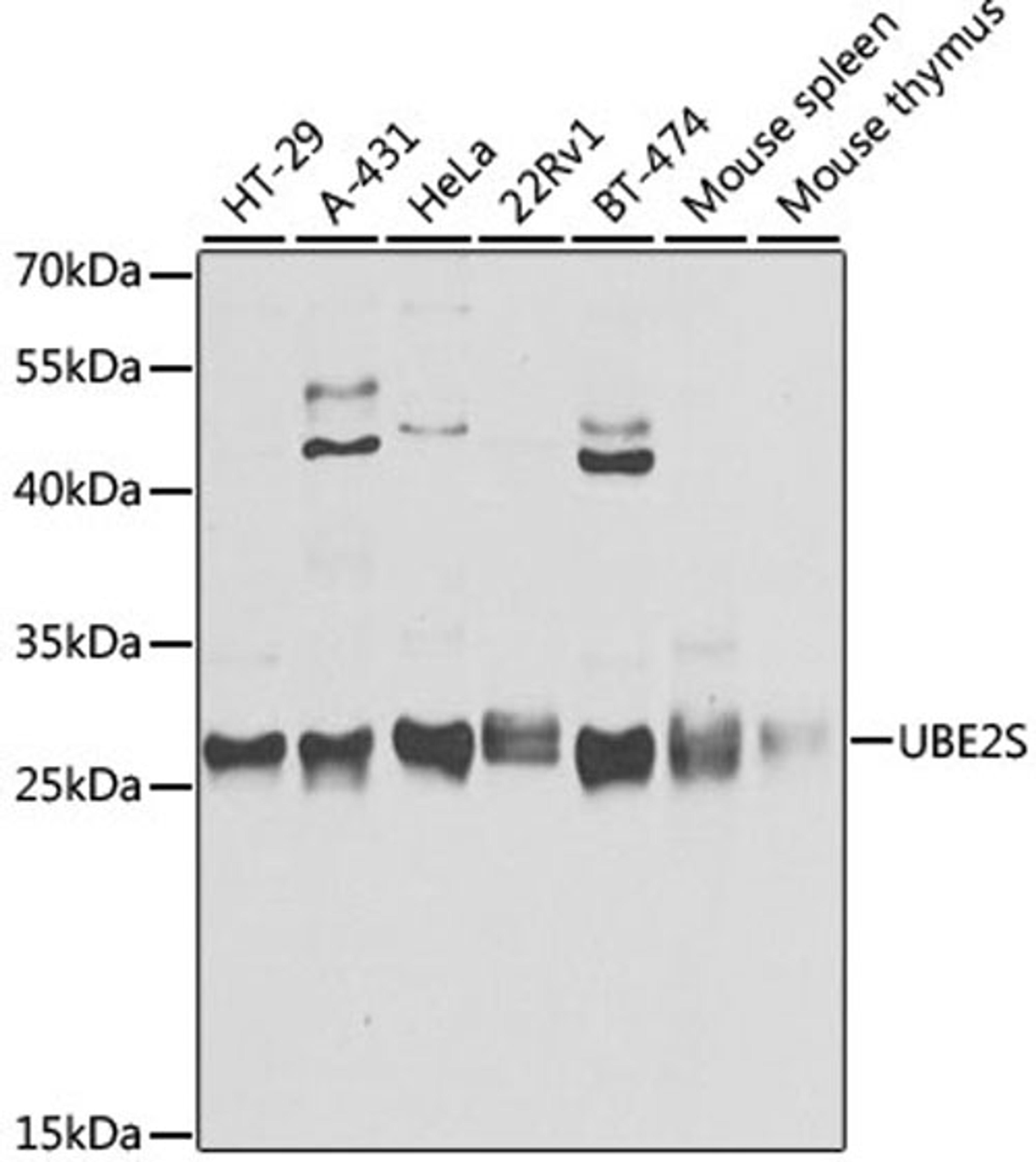 Western blot - UBE2S antibody (A4658)