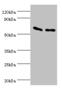 Western blot. All lanes: ATP synthase subunit beta, mitochondrial antibody at 9ug/ml. Lane 1: Hela whole cell lysate. Lane 2: HepG2 whole cell lysate. Secondary. Goat polyclonal to rabbit IgG at 1/10000 dilution. Predicted band size: 57 kDa. Observed band size: 57 kDa. 