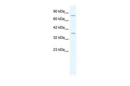 Antibody used in WB on Human Jurkat cells at 1.25 ug/ml.