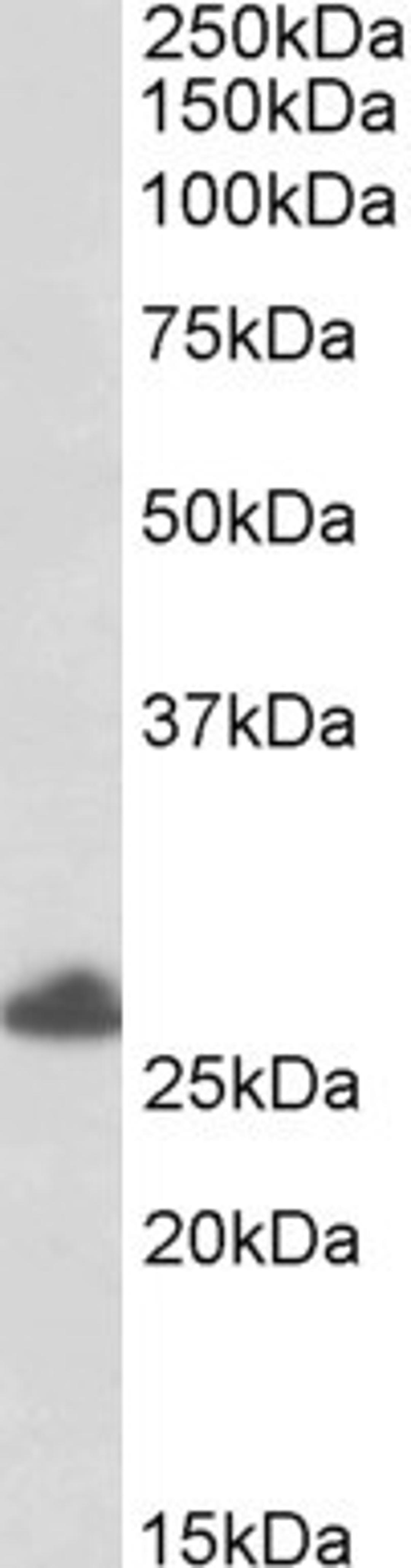 46-310 (0.5ug/ml) staining of Human Placenta lysate (35ug protein in RIPA buffer). Primary incubation was 1 hour. Detected by chemiluminescence.