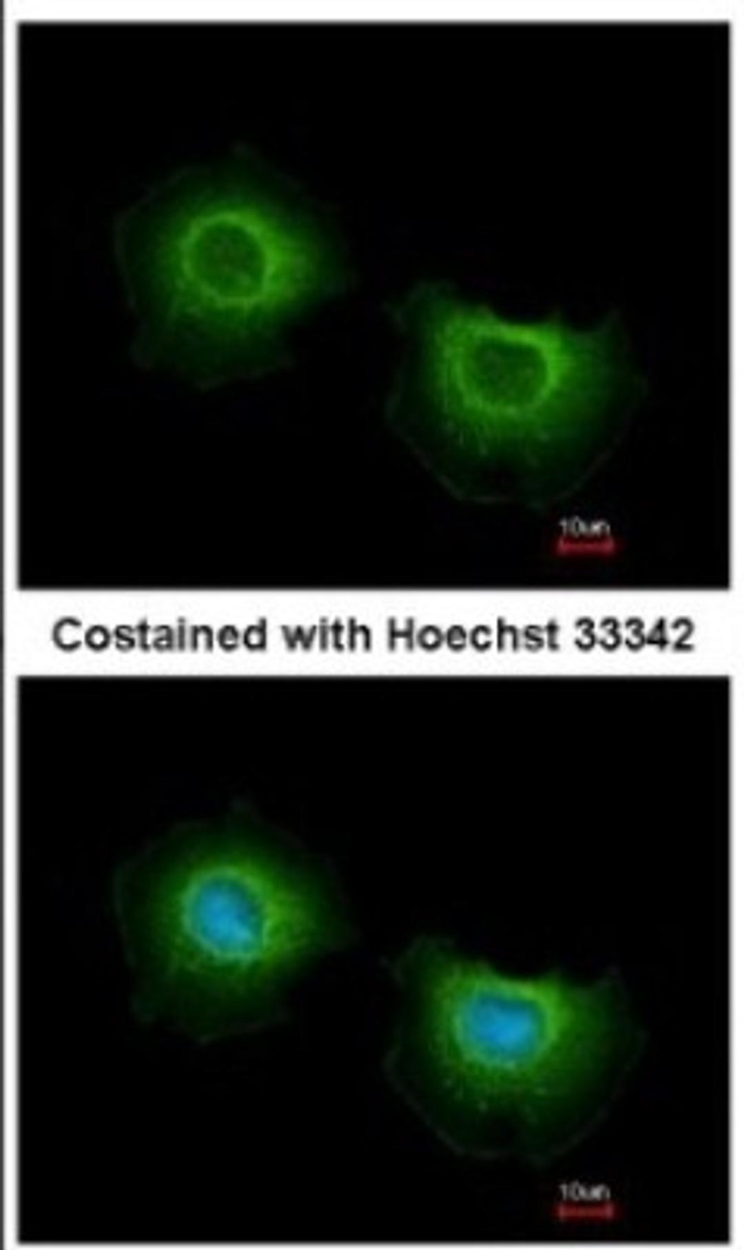 Immunocytochemistry/Immunofluorescence: ST3GAL3 Antibody [NBP2-20491] - Analysis of methanol-fixed MCF-7, using antibody at 1:500 dilution.