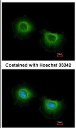 Immunocytochemistry/Immunofluorescence: ST3GAL3 Antibody [NBP2-20491] - Analysis of methanol-fixed MCF-7, using antibody at 1:500 dilution.