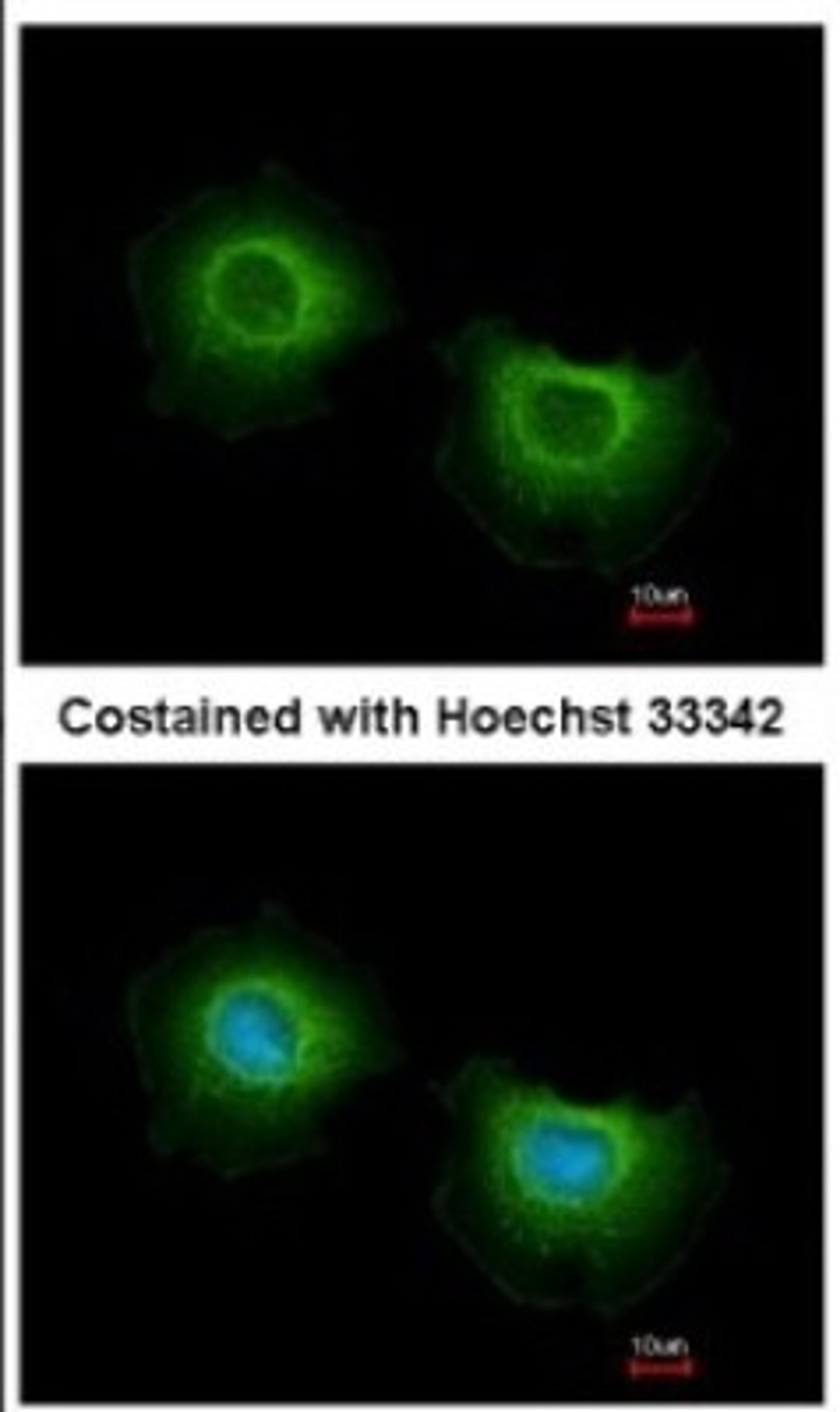 Immunocytochemistry/Immunofluorescence: ST3GAL3 Antibody [NBP2-20491] - Analysis of methanol-fixed MCF-7, using antibody at 1:500 dilution.